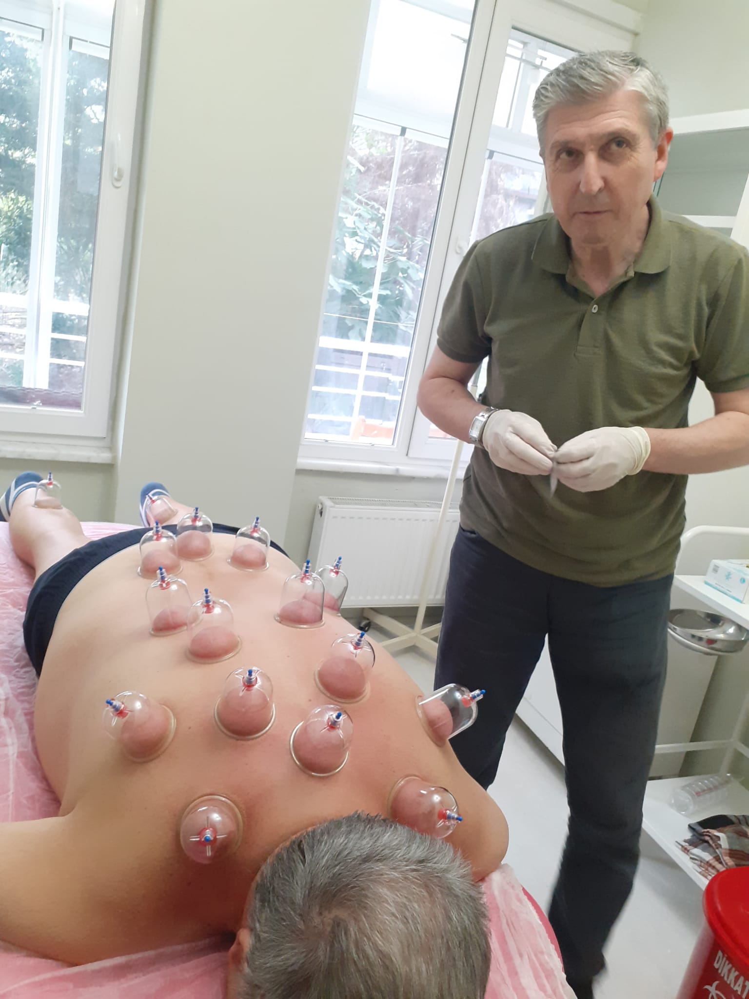 Hacamat tedavisi - Cupping therapy